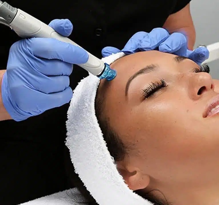 How does Botox work e16189363899