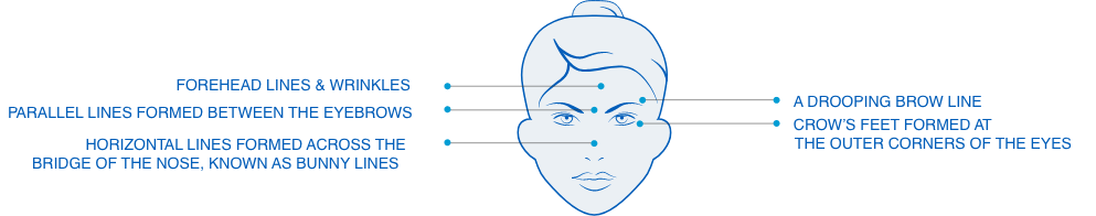 Neurotoxin Face Map