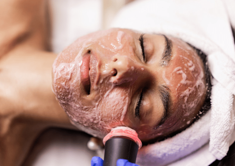 Woman receiving an OxyGeneo facial.