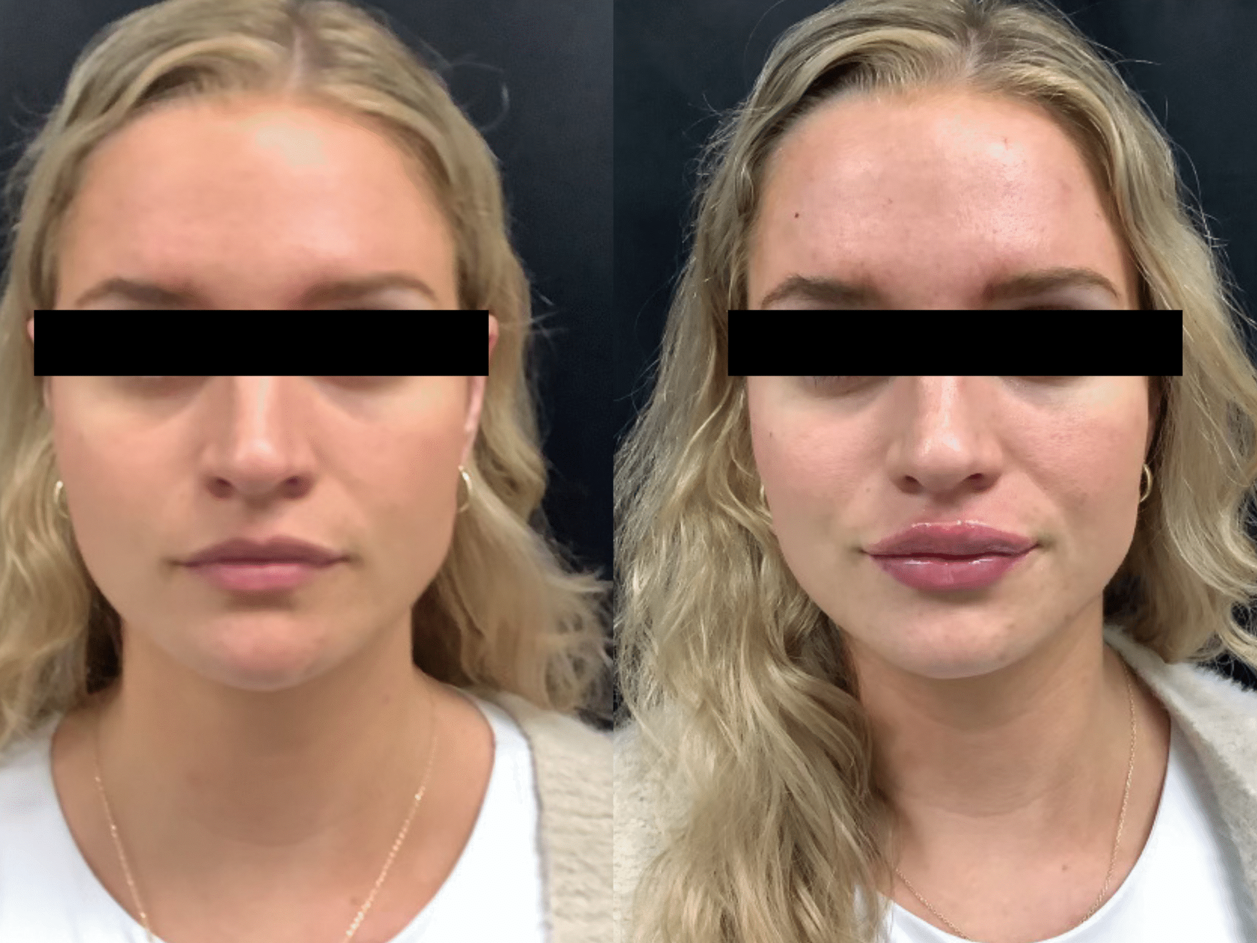Courtney B&A2 (5)