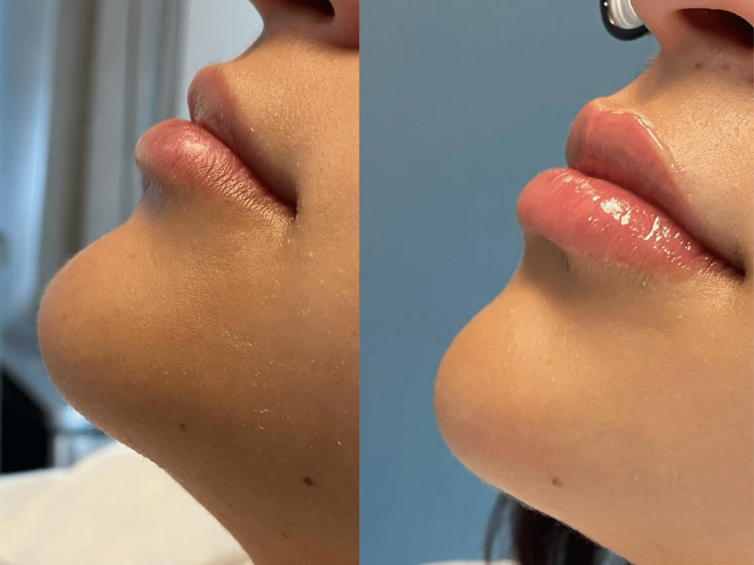 cheryl B&A2