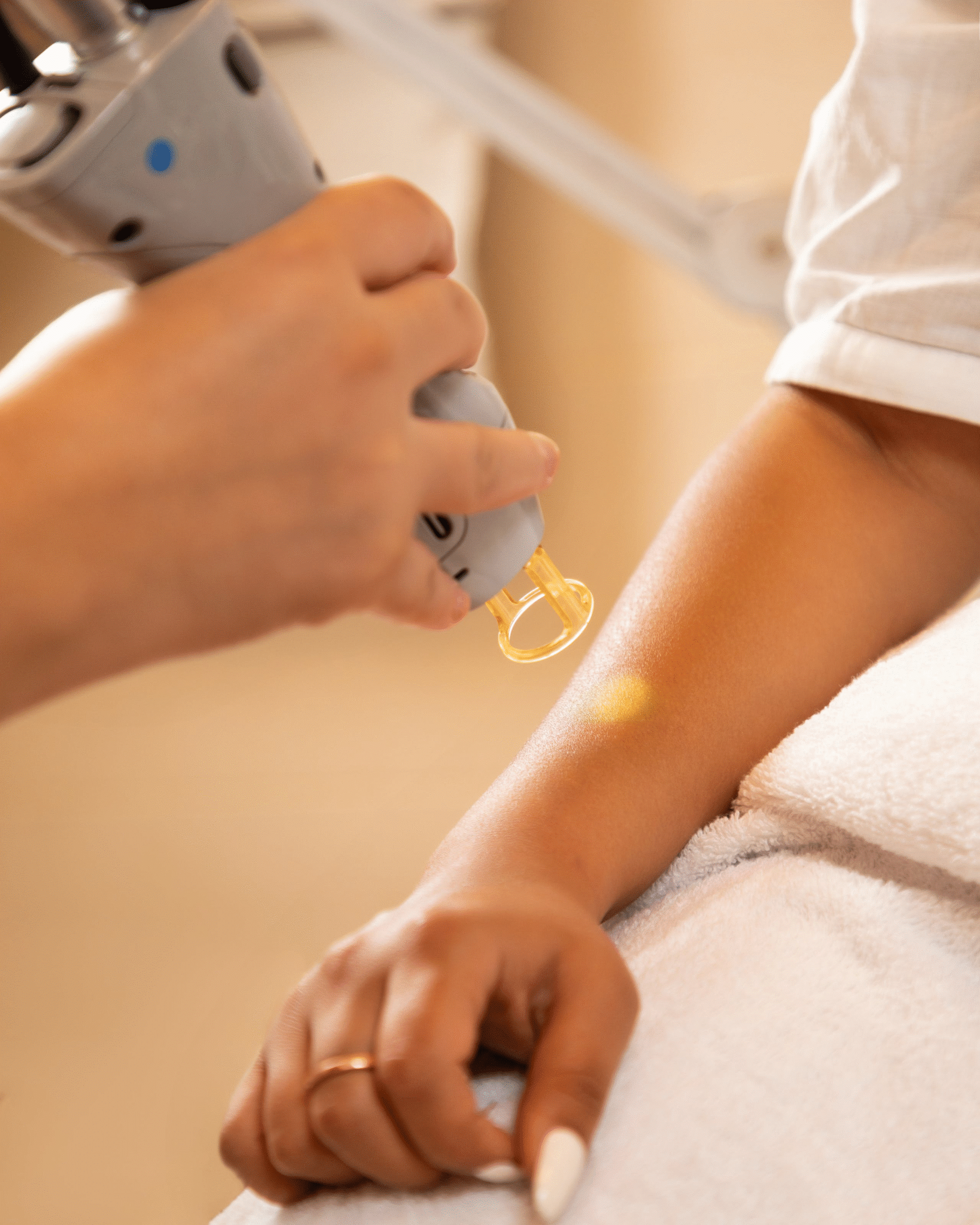 laser hair removal (3)