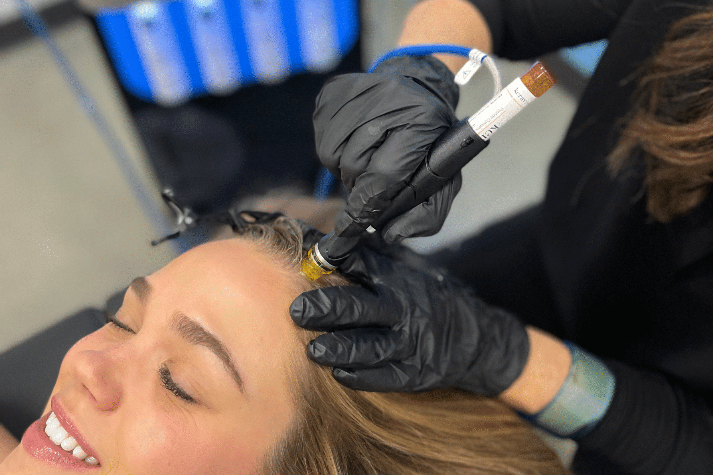 HydraFacial Keravive for Hair Loss Atlanta GA HydraFacial Keravive for Hair Loss Atlanta GA