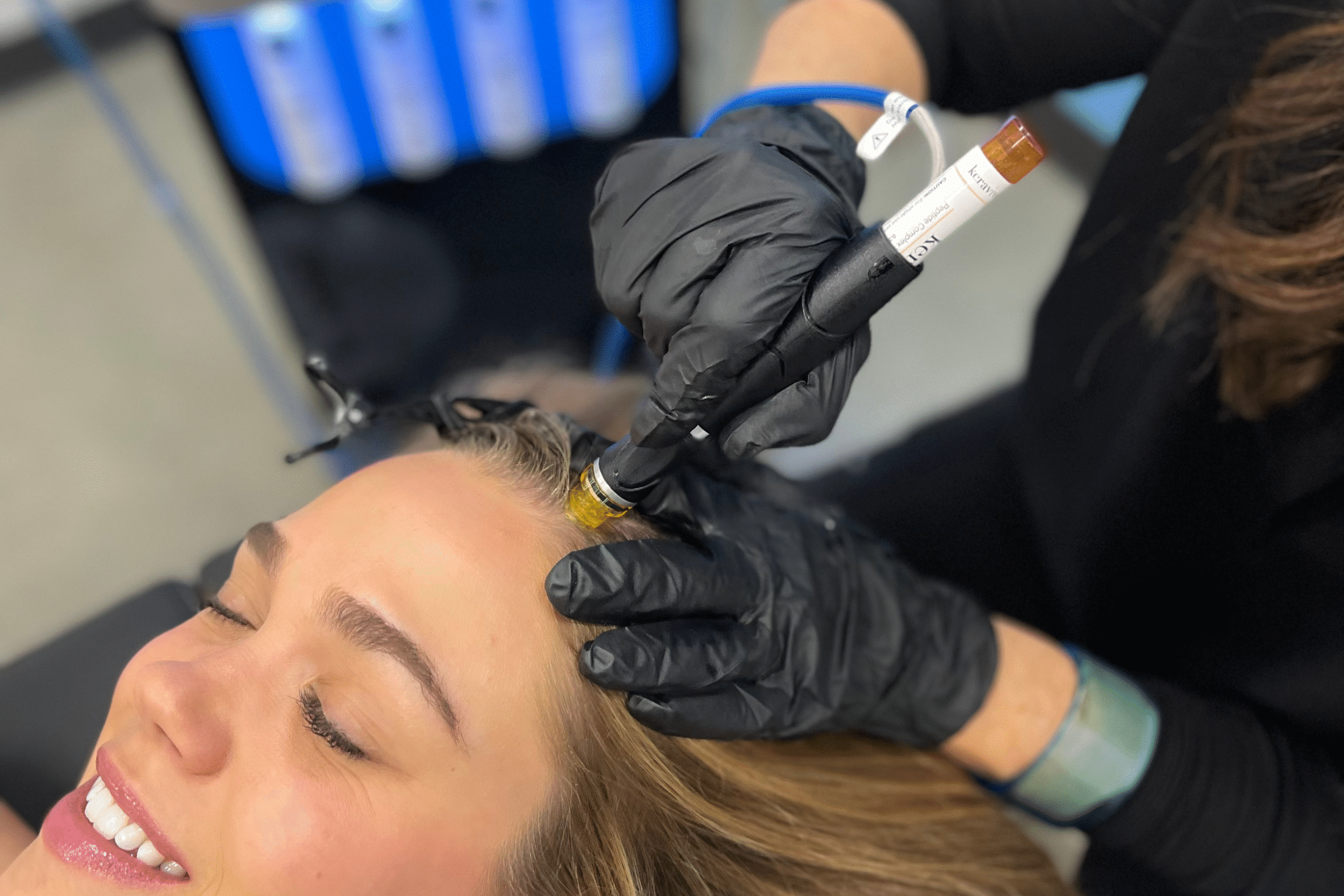 keravive scalp hydrafacial